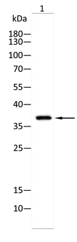 CTSL/CTSV/CTSK/CTSH Antibody