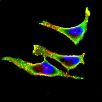 CTSL/CTSV/CTSK/CTSH Antibody