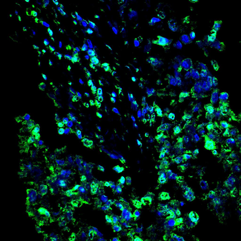 CTSL/CTSV/CTSK/CTSH Antibody