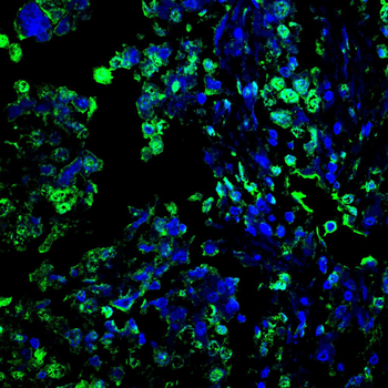 CTSL/CTSV/CTSK/CTSH Antibody