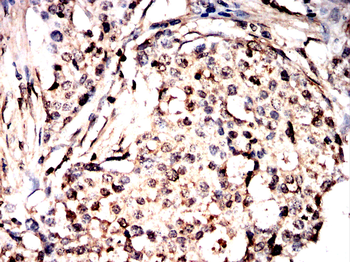 CTSL/CTSV/CTSK/CTSH Antibody