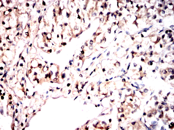 CTSL/CTSV/CTSK/CTSH Antibody