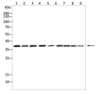 CTSL/CTSV/CTSK/CTSH Antibody