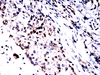POLB Antibody