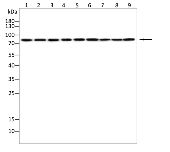 ABCD1 Antibody