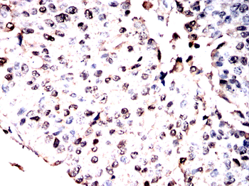 MTDH Antibody