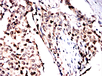 MTDH Antibody