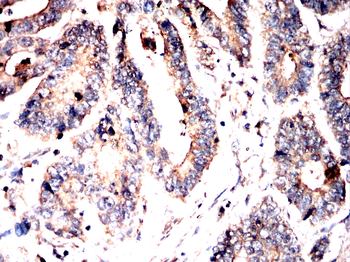 MTDH Antibody