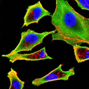 MTDH Antibody