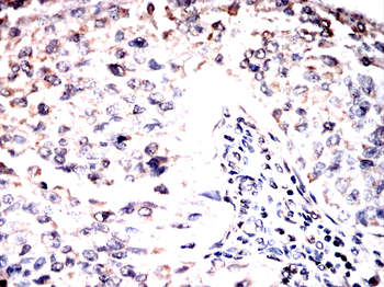 MTDH Antibody