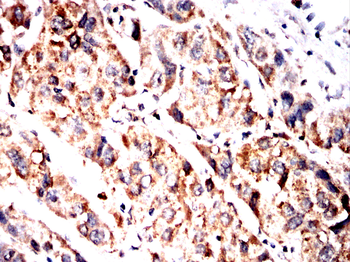 MTDH Antibody