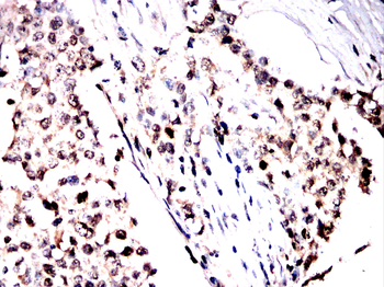 MTDH Antibody