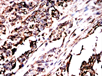 PDHA1 Antibody