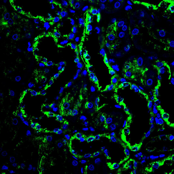 PDHA1 Antibody