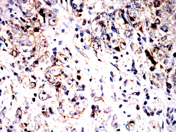 PDHA1 Antibody