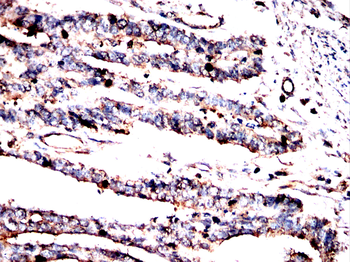 PDHA1 Antibody