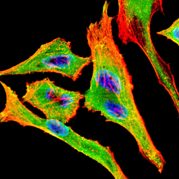 PDHA1 Antibody