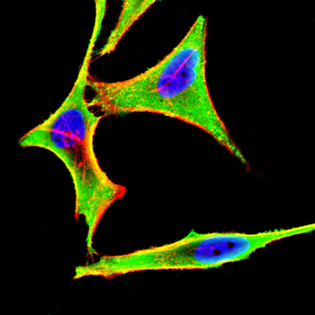 NDUFS4 Antibody