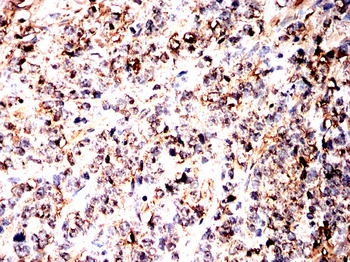 NDUFS4 Antibody