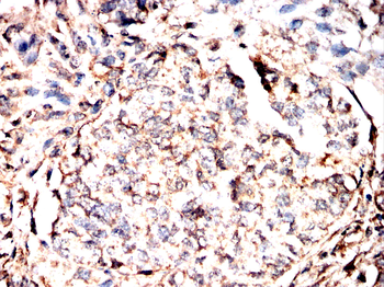 FOXO3 Antibody