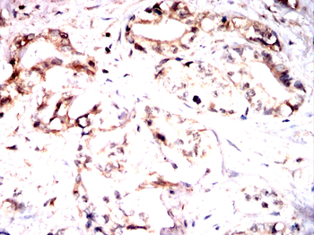 FOXO3 Antibody