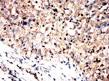 FOXO3 Antibody