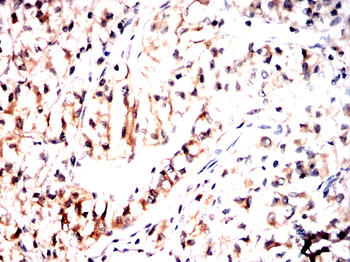 FOXO3 Antibody