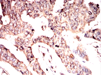 RAP1A/RAP1B Antibody