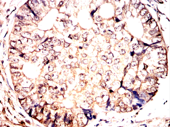 RAP1A/RAP1B Antibody
