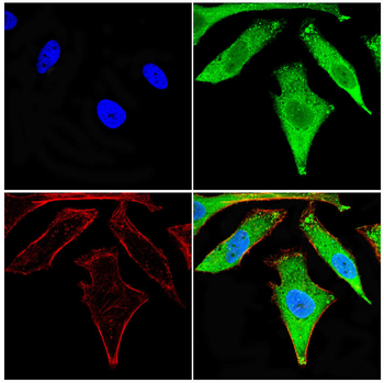 SV2A Antibody