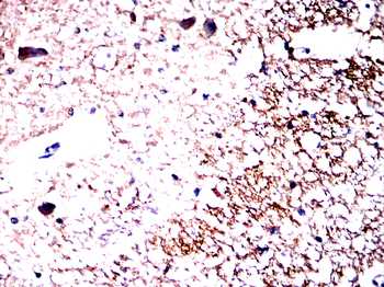 SV2A Antibody