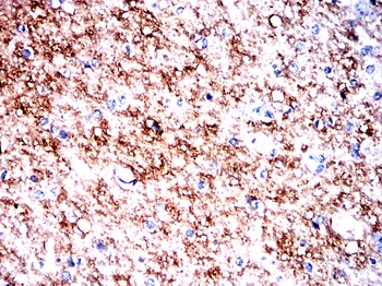 SV2A Antibody