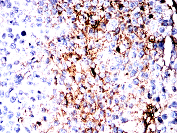 SV2A Antibody