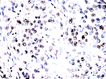 CCNK Antibody