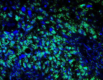 CCNK Antibody