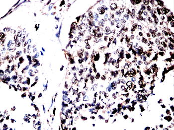 CCNK Antibody