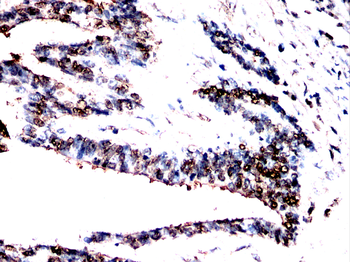 CCNK Antibody