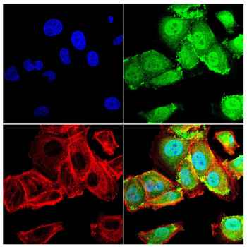 LPIN1 Antibody