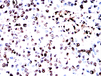 LPIN1 Antibody