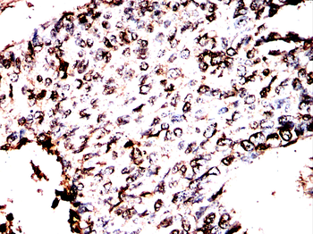 LPIN1 Antibody