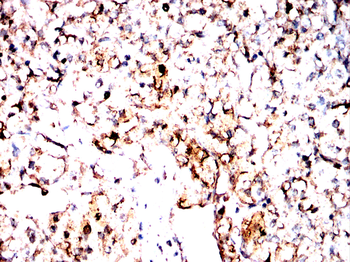 LPIN1 Antibody