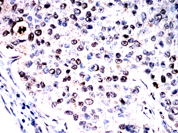 LYPLA1 Antibody