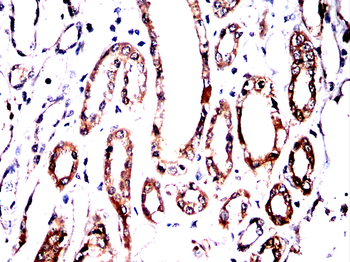 LYPLA1 Antibody