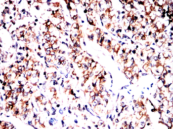 LYPLA1 Antibody