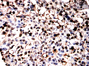 PPIA Antibody