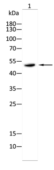 CS Antibody