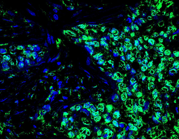 MEF2D Antibody