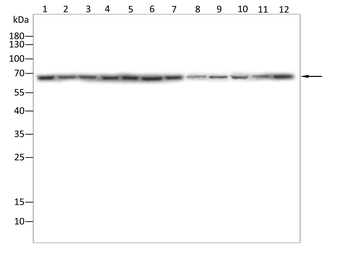 MEF2D Antibody