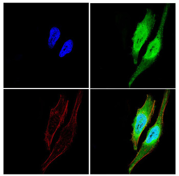 MEF2D Antibody