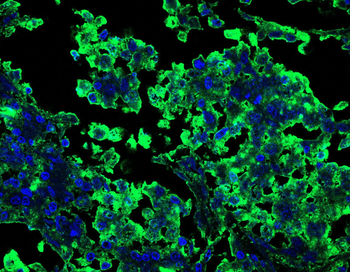 DHODH Antibody